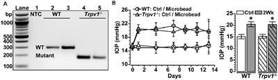 TRPV1 Supports Axogenic Enhanced Excitability in Response to Neurodegenerative Stress